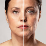 MASAJEADOR FACIAL REDUCTOR DE ARRUGAS